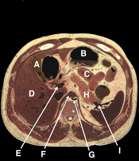 Department Of Anatomy And Cellular Biology Cross Sectional Anatomy Home ...