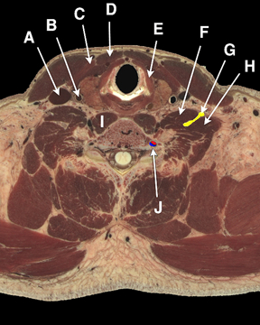 Department Of Anatomy And Cellular Biology Cross Sectional Anatomy Home ...