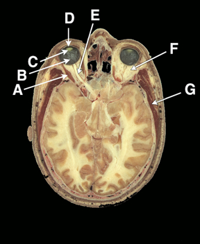 Department of Anatomy and Cellular Biology Cross Sectional Anatomy Home ...