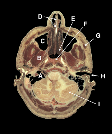 Department of Anatomy and Cellular Biology Cross Sectional Anatomy Home ...