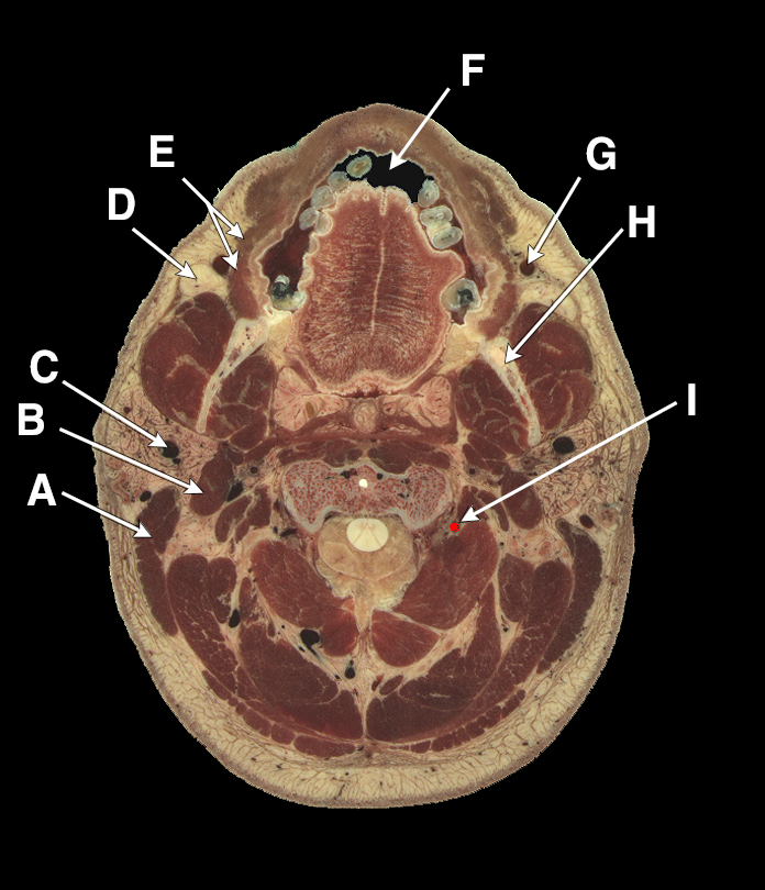 Department of Anatomy and Cellular Biology Cross Sectional Anatomy Home