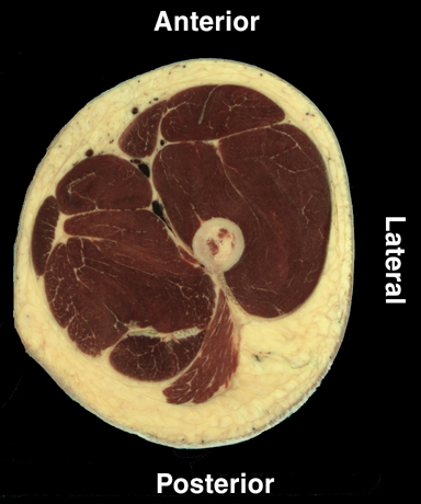 Department Of Anatomy And Cellular Biology Cross Sectional Anatomy Home ...